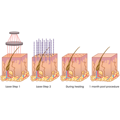 Product Detail Image